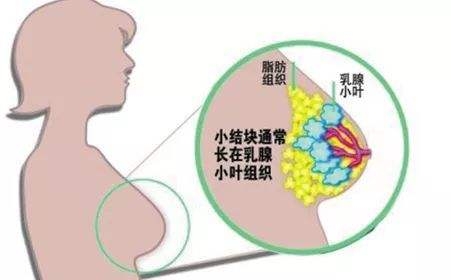 乳腺安全不能忽视，健康内衣印后与夏娃之秀掀起浪潮