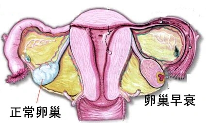 卵巢早衰绝经生育功能——AMH值可逆转？中科生殖三大科研临床技术成果及案例公布(图2)