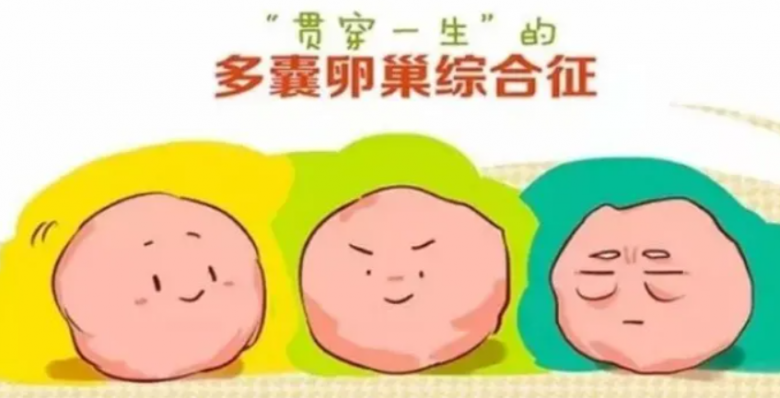 深圳孕宝国际：多囊卵巢如何治疗？一定要做试管婴儿吗？