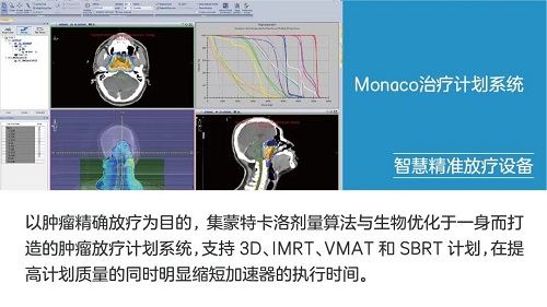 最先進的立體定向放射外科(srs)和立體定向體部放射治療(sbrt)技術